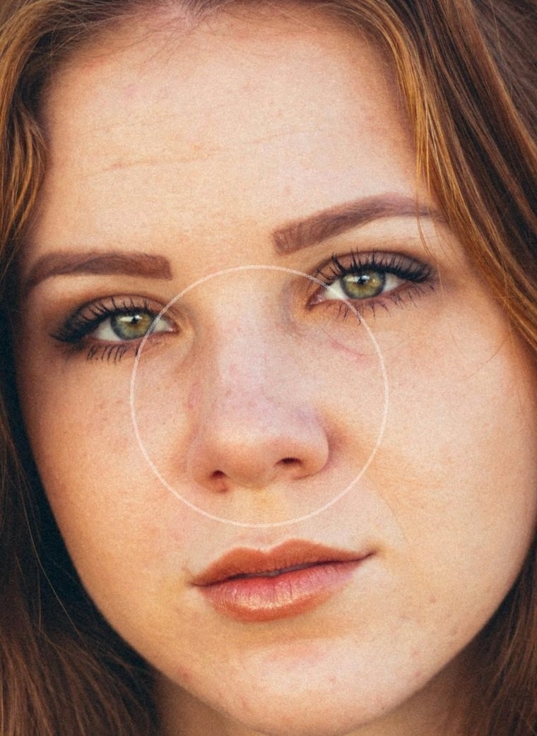 Before: Before and after AI preview of a rhinoplasty made in Pody, red-haired woman with freckles, front view